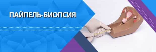 Современная Пайпель-биопсия в Санкт-Петербурге: Эффективная и Безопасная Диагностика Эндометрия